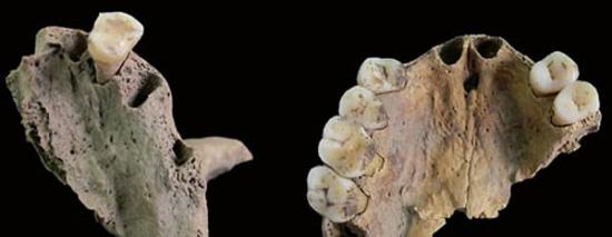 青龙泉新石器时代居民牙齿生前脱落。（周蜜供图）