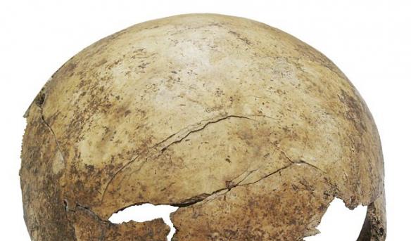 德国法兰克福附近发现7000年前集体墓穴里一个8岁小孩儿的断裂的颅骨
