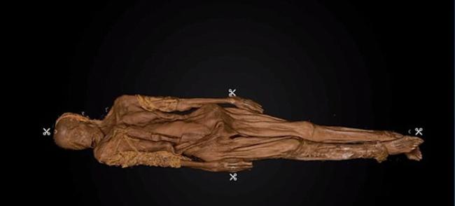 美国纽约皇后区工地挖出19世纪铁棺女尸 死因是天花