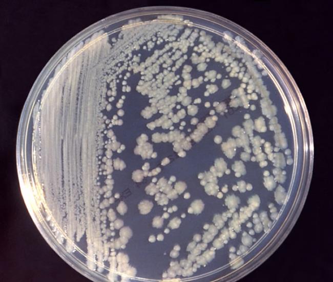 国际空间站发现肠杆菌菌株 研究它们避免对宇航员造成健康影响