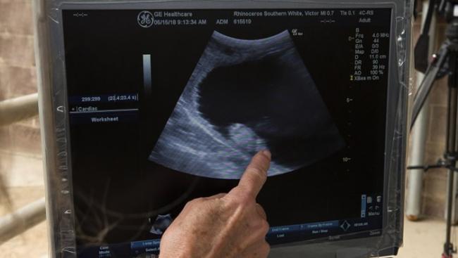 超声波照显示，人工受孕的胚胎正在维多利亚体内成长。