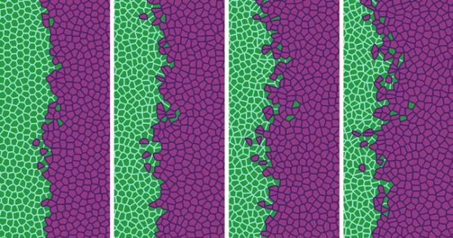 该图像显示癌细胞（紫红色）如何逐渐置换健康细胞（绿色）（图片来源:UC3M/UCM）