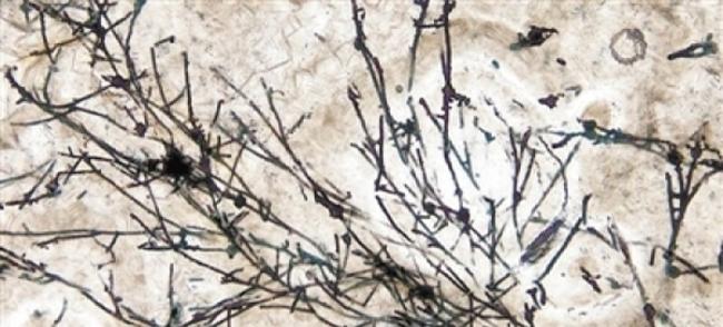 真菌状微化石的显微图像。图片来源：美国趣味科学网站