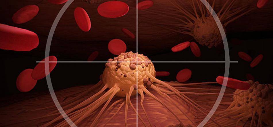 《标准晚报》：苏格兰科学家成功试验能够杀死癌细胞又不损害健康组织的药物
